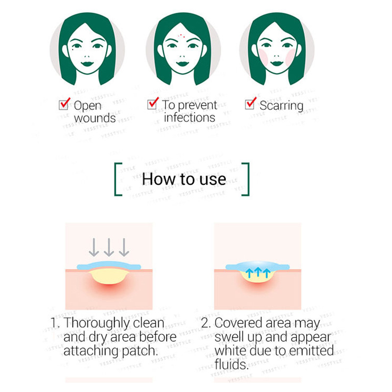 Some By Mi - 30 Days Miracle Clear Pimples/Scars Spot Patch